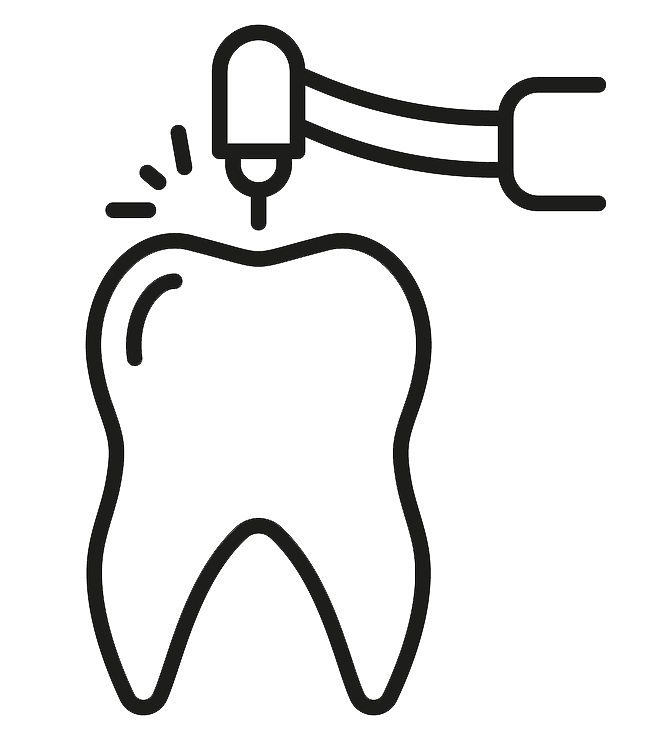 Root Canal Treatment (Initial RCT) Root Canal Treatment (Initial RCT)